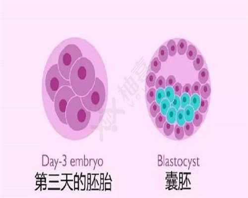 宫外孕和输卵管妊娠一次，需要做手术吗？还能不能怀孕啊？