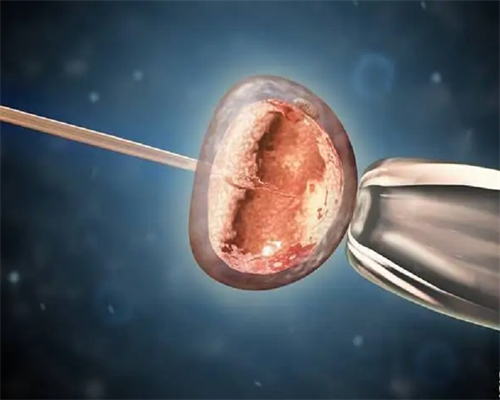 促排卵针辅助下卵泡数量对代生套餐成功率的影响！推荐哪些医院！