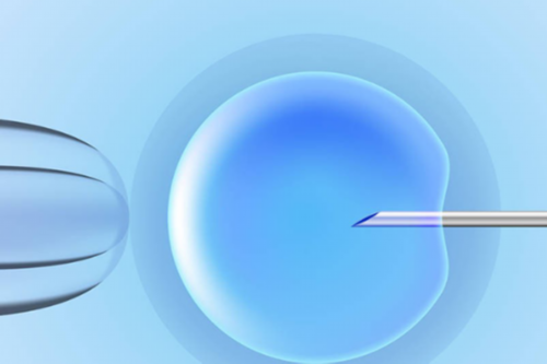 卵巢衰退怎么做试管移植？卵巢功能衰退做试管婴儿成活率是多少？