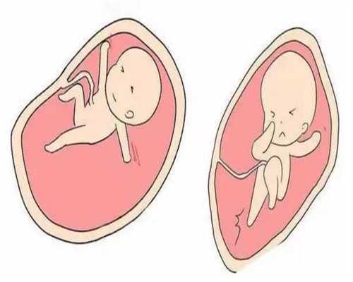 广西试管婴儿减免费用_广西试管婴儿技术怎么样